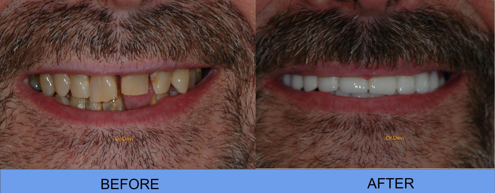Prosthodontics