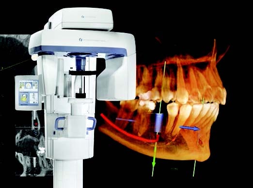 Dental panoramic X-ray imaging technology