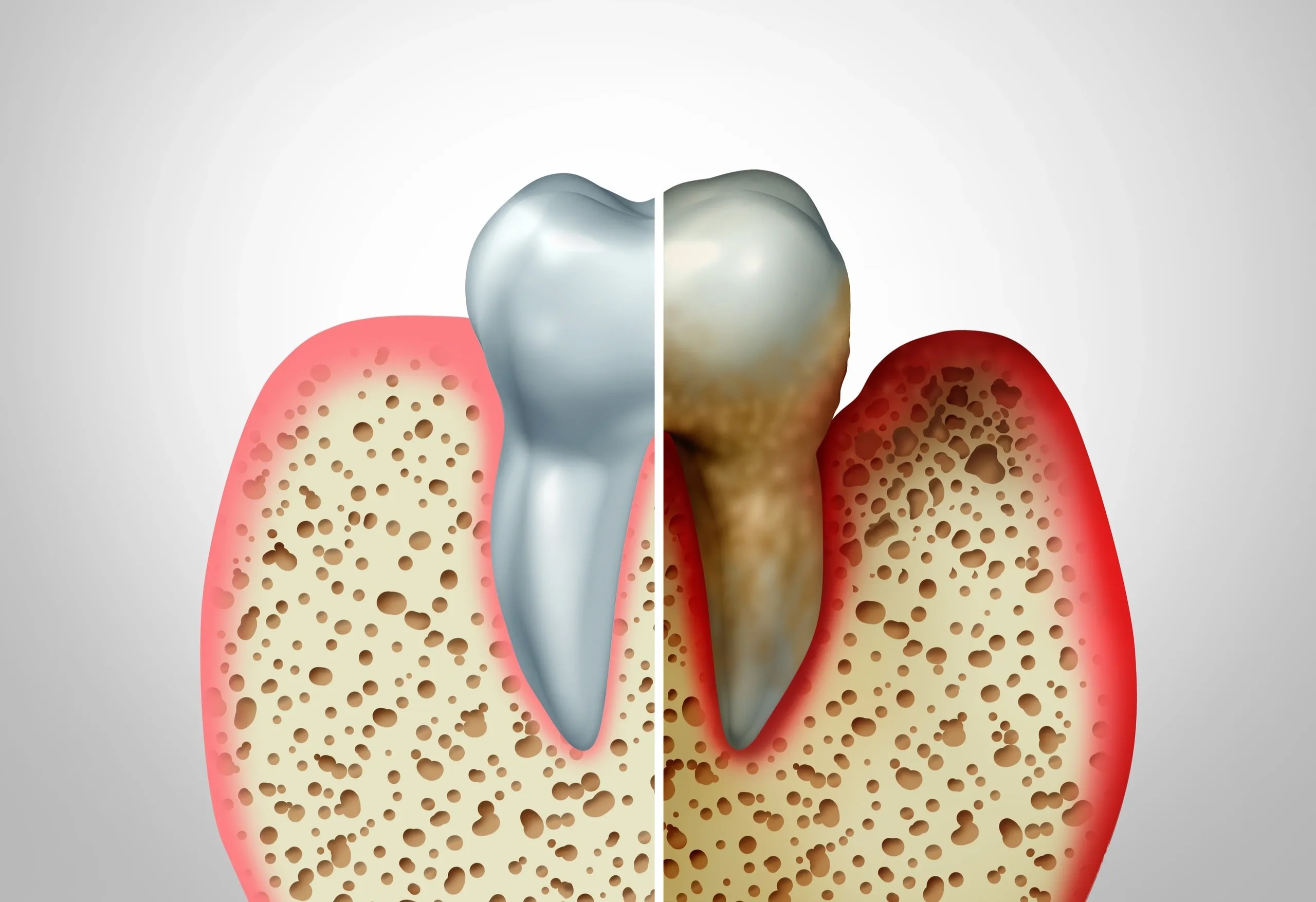 Periodontal Care