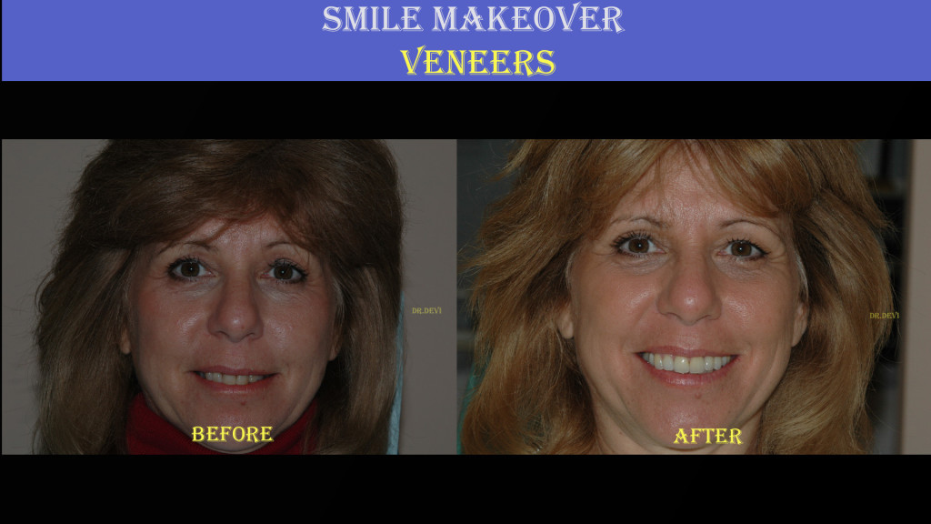 Before and After Pictures of Treatments Completed by Dr.Devi